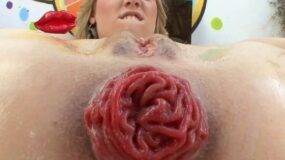 gape_and_prolapse